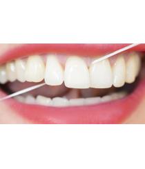 Diş Eti Hastalıkları Tedavisi (Periodontoloji)